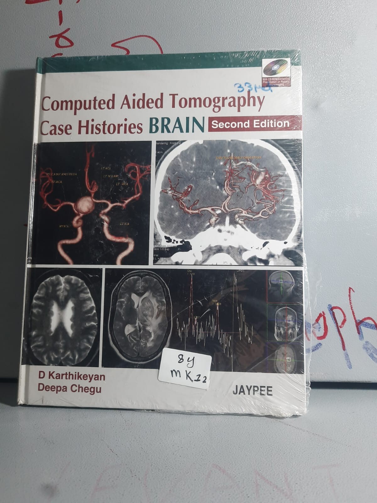 Computed Aided Tomography Case Histories BRAIN 
