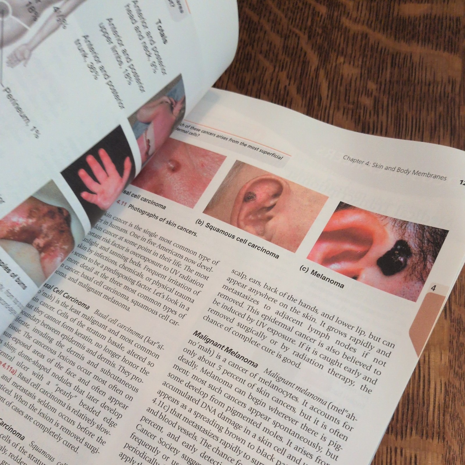 Essentials of Human Anatomy and – Paperback, by Suzanne Keller Acceptable 13 ed
