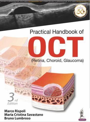 Practical Handbook of Oct : (Retina, Choroid, Glaucoma), Paperback by Rispoli…
