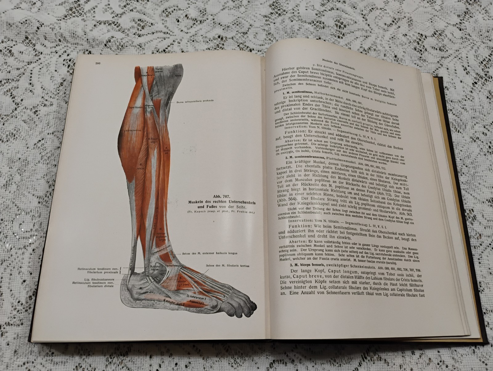 Atlas Of Human Anatomy 1952 Vol 1 In German Skeletal, Muscular General systems