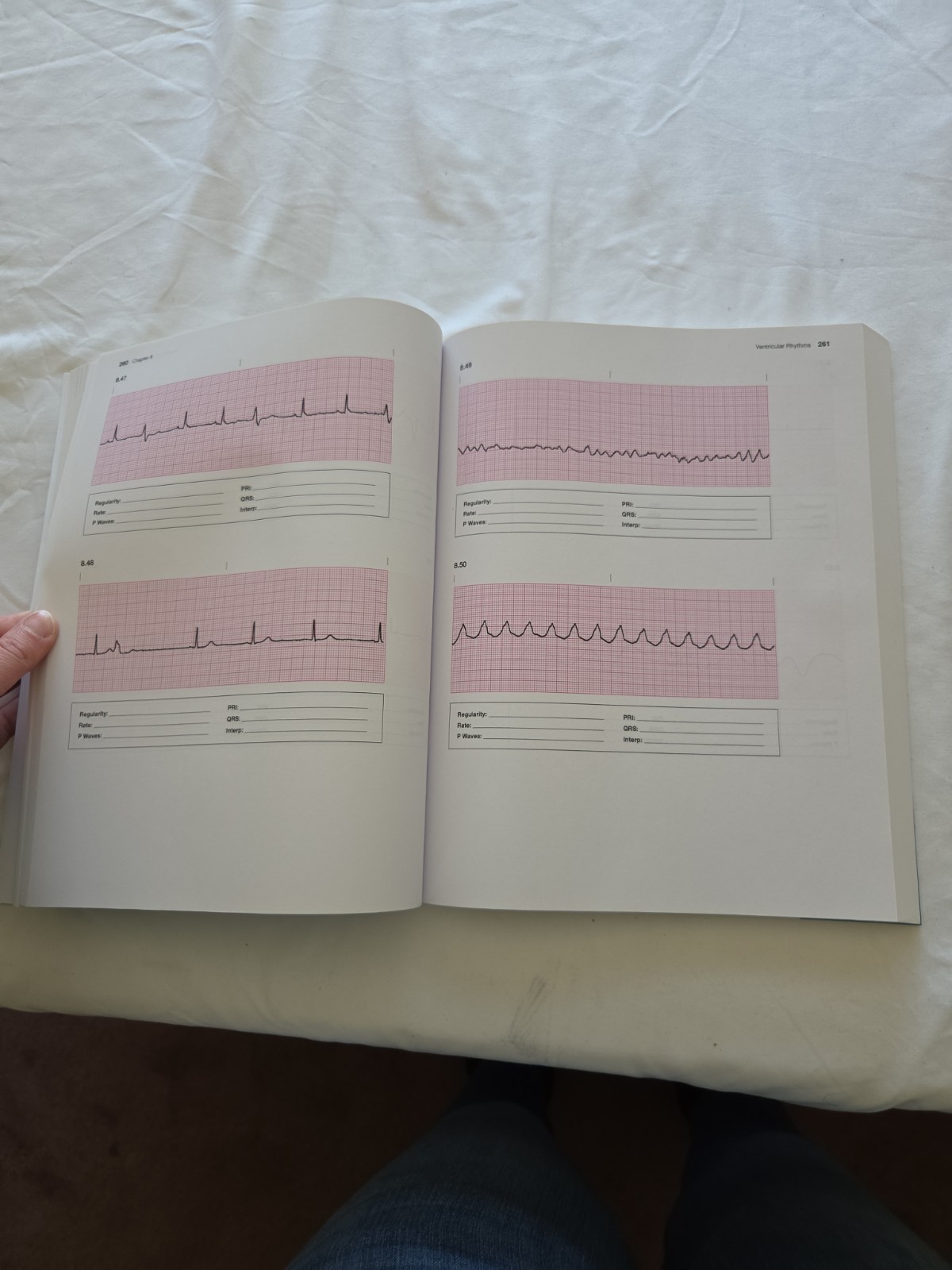 Basic Arrhythmias With 12-Lead EKGs 8th Edition Paperback By Walraven, Gail