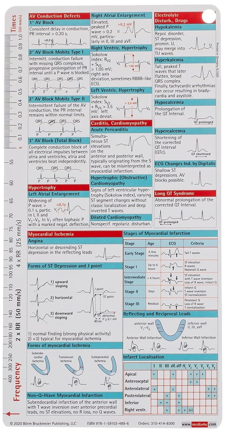 ECG pocketcard