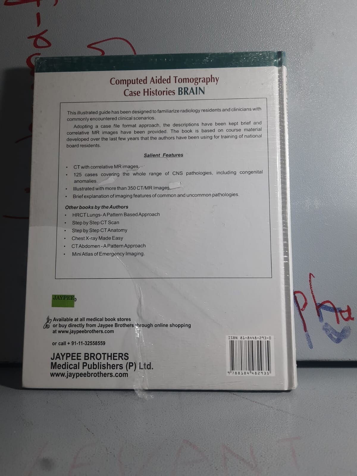 Computed Aided Tomography Case Histories BRAIN 