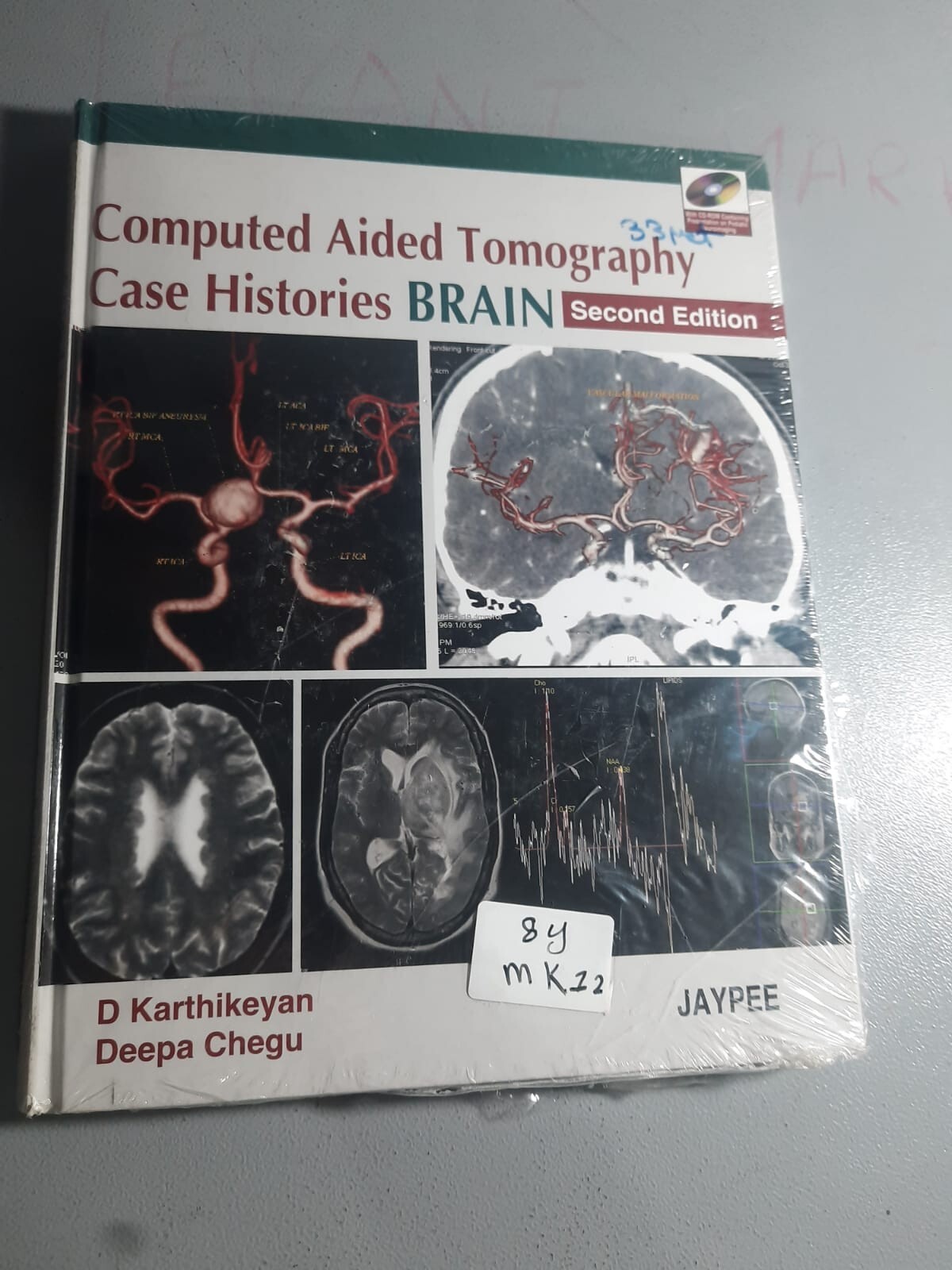 Computed Aided Tomography Case Histories BRAIN 