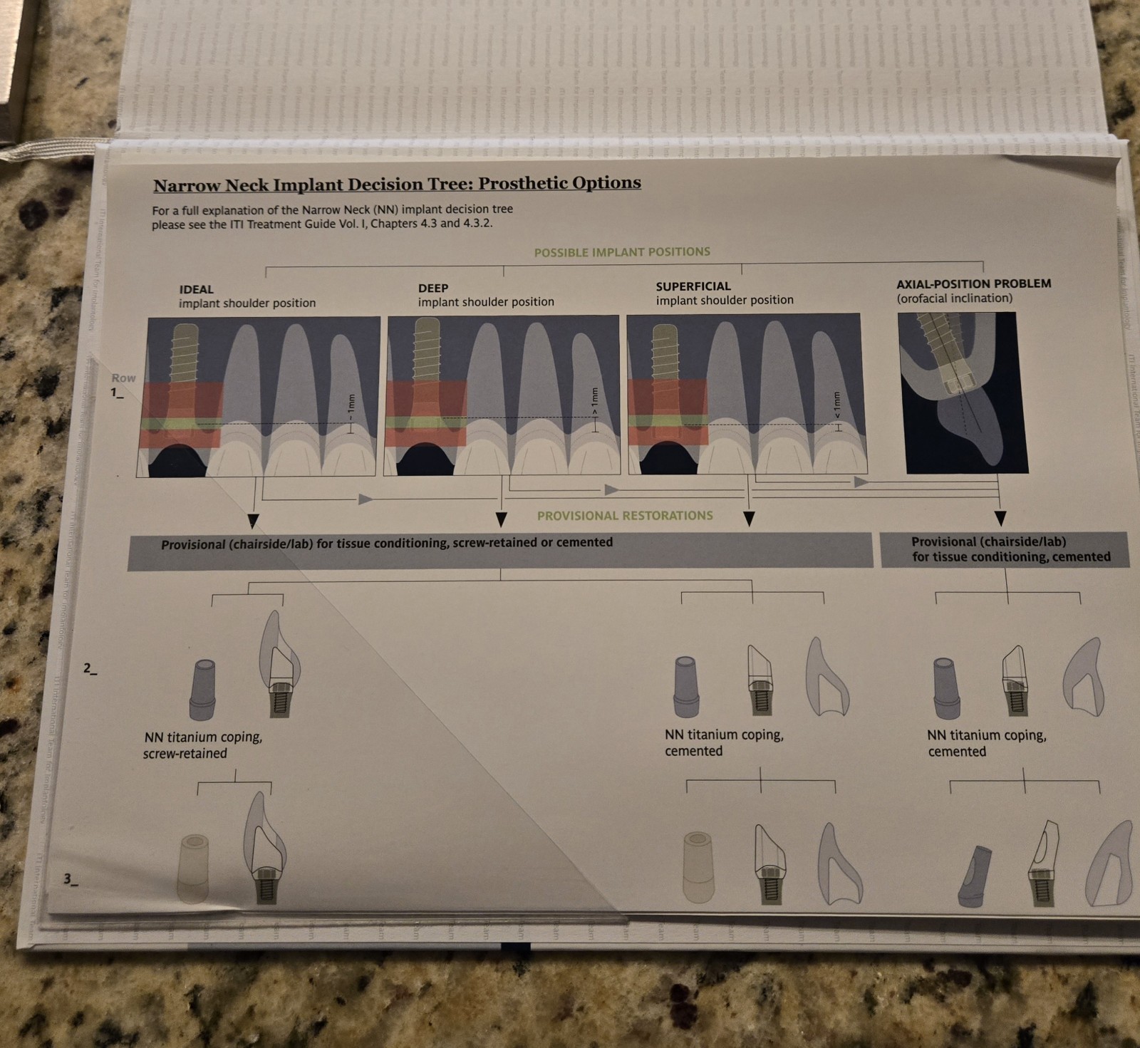 ITI TREATMENT GUIDE, VOLUME 1: IMPLANT THERAPY IN ESTHETIC ZONE SINGLE TOOTH REP